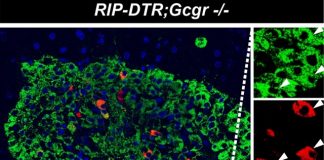 Anti-GCGR mAb treatment