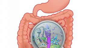 Bacteria in the colon linked to type 2 diabetes