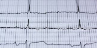 New blood thinner may help people with irregular heartbeat