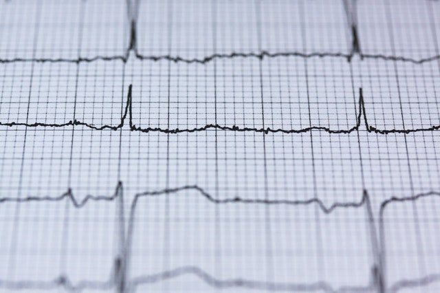 New blood thinner may help people with irregular heartbeat