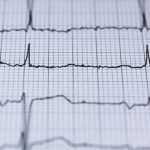 People with abnormal heart rhythm need continuous treatment to prevent stroke