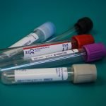 Blood test and imaging together could improve prostate cancer diagnosis