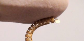 'Smart stent’ could detect narrowing of arteries