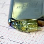 8 medical devices that may improve your heart health