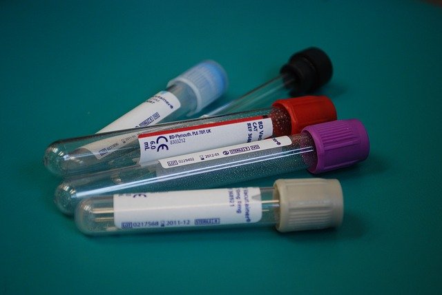 A groundbreaking blood test for PTSD