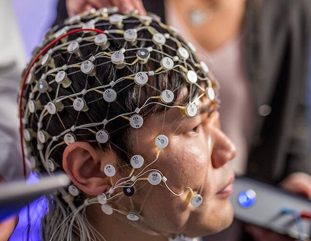 New brain stimulation may help treat depression