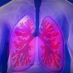 People with lung diseases need to take care of their heart