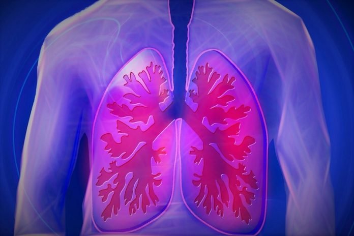 Breakthrough in lung cancer diagnosis and treatment