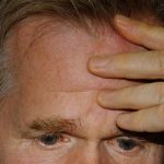 Deep forehead wrinkles may signal big health problems