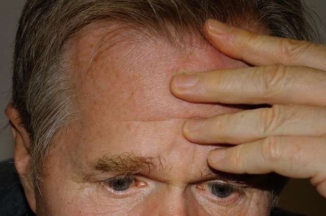 Deep forehead wrinkles may signal big health problems