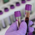 New blood test could detect chronic fatigue syndrome