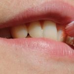 Teeth whitening products may harm your tooth health