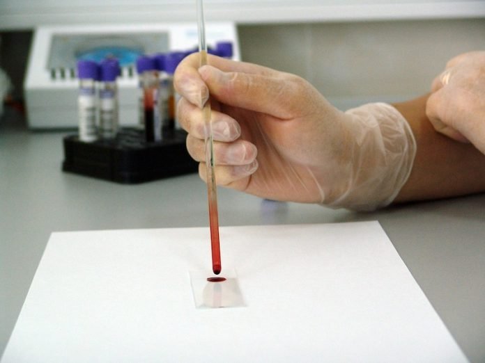 This new blood test may detect Alzheimer’s disease early
