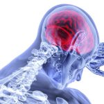 What you should know about traumatic brain injury