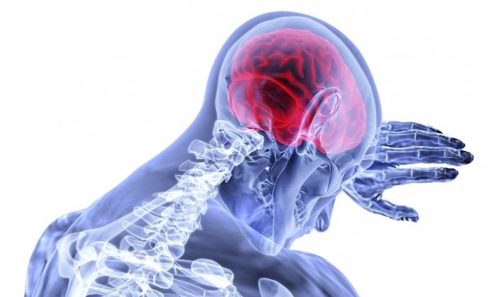 What you should know about traumatic brain injury
