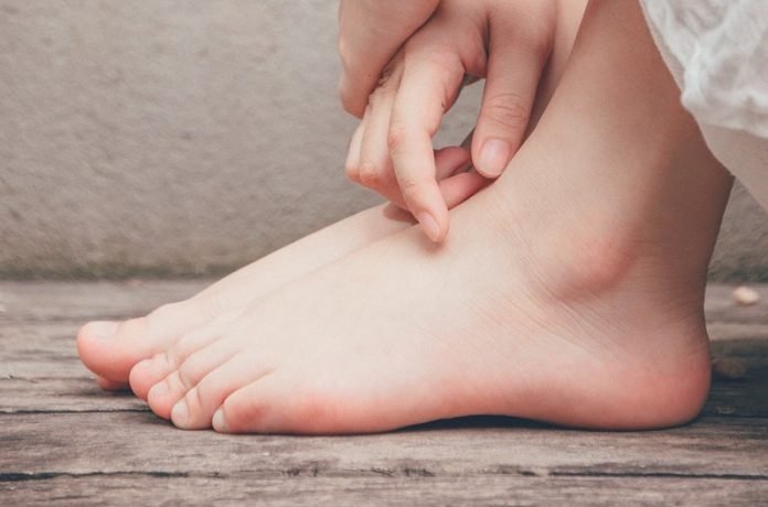 Scientists find a better way to reduce painful attacks in gout