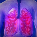 This drug may cut lung cancer risk by 30% in people with COPD