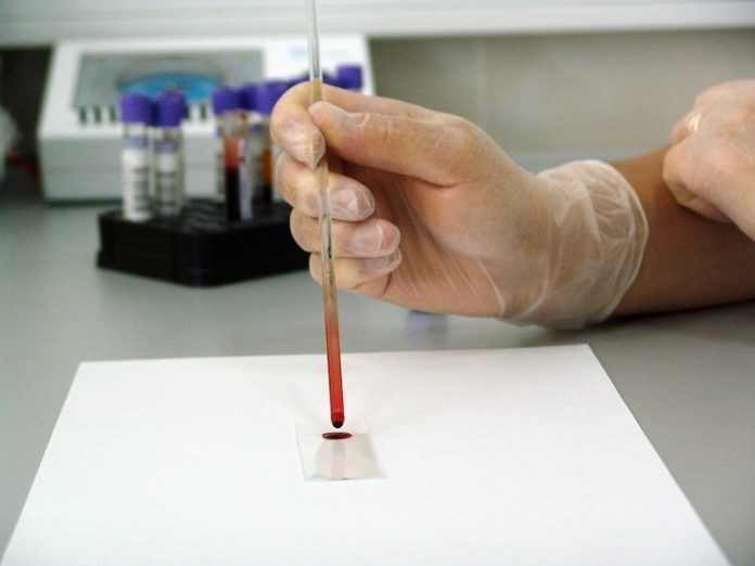 This simple new blood test could detect 7 types of cancer