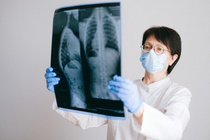 COVID-19 can completely damage lungs, study shows