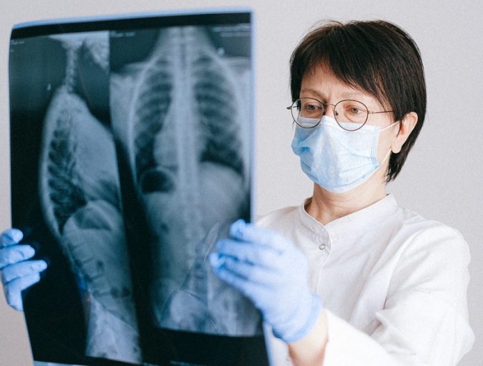 Scientists find 2 phases of lung infection in people with severe COVID-19