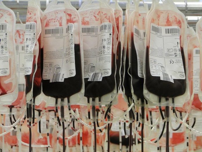 COVID-19 survivors' blood may save older patients, study finds
