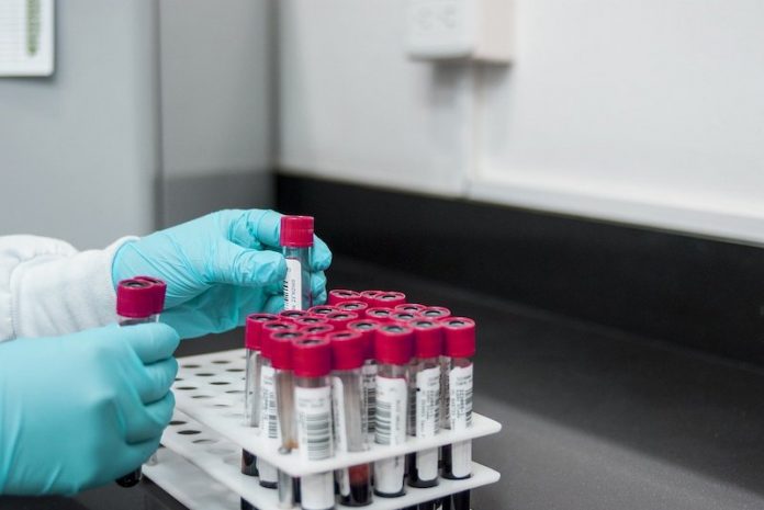 Too much of this stuff in your body may strongly reduce your lifespan