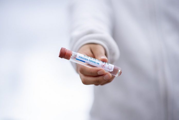 This new rapid test can detect COVID-19 infection in 10 minutes