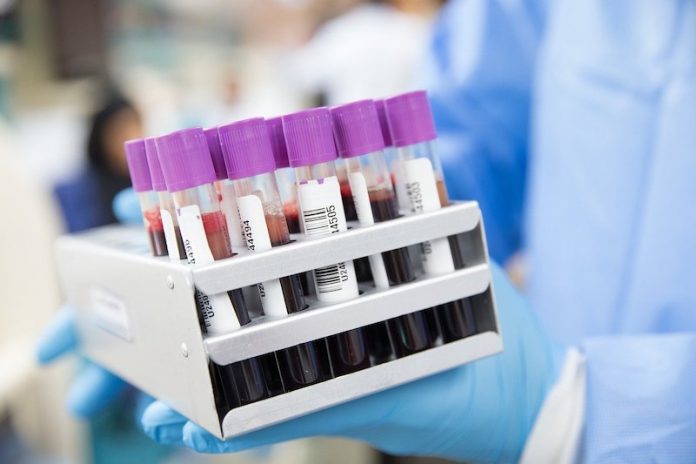 This blood test that can detect more than 50 types of cancer