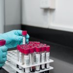 This study shows a new way to stop inflammation