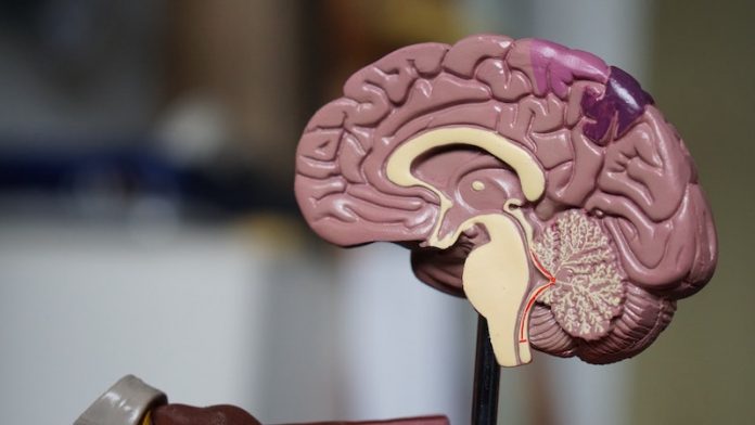 Scientists find 11 genetic variants for Alzheimer's disease