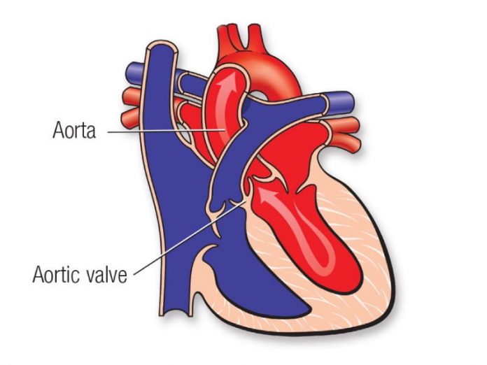 More people die from tears in this major heart artery, study finds