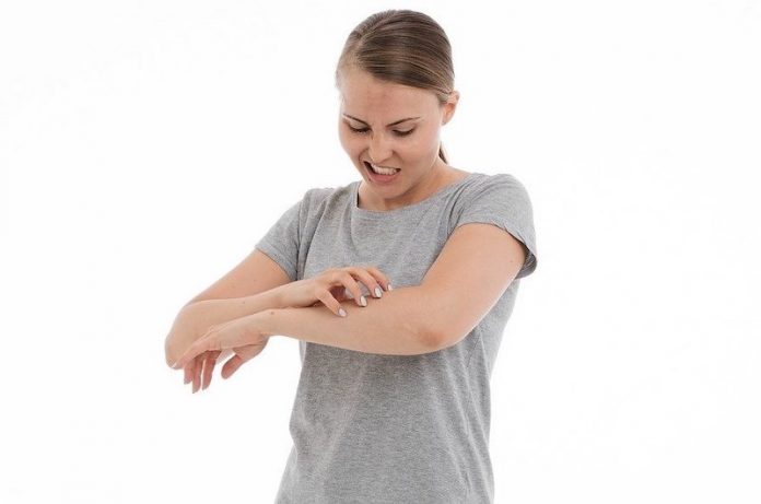 Itchy, scaly skin_ living with psoriasis