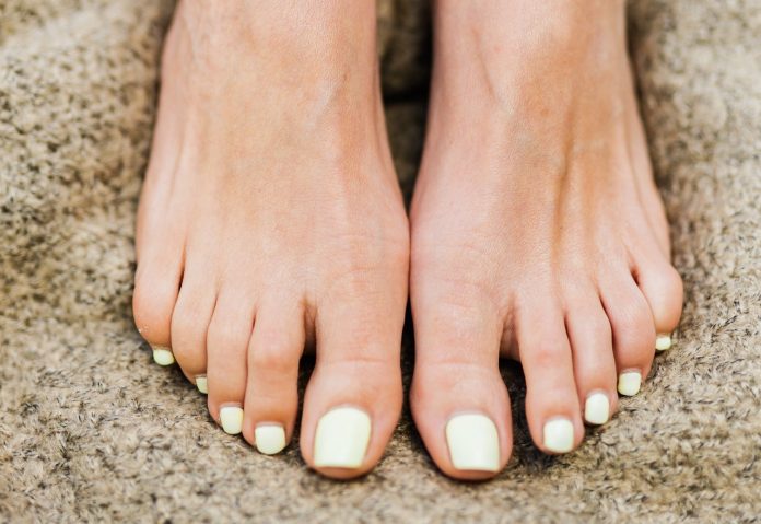What you need to know about gout