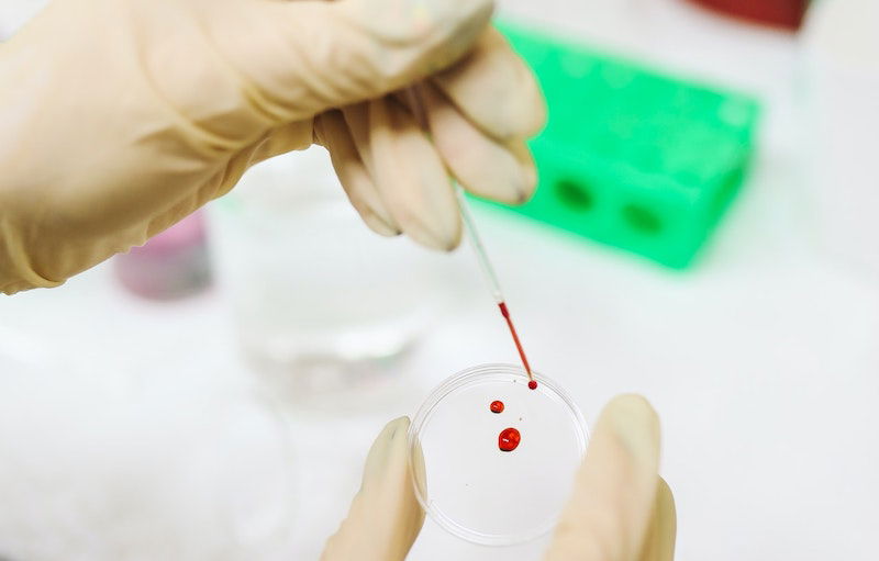 Scientists find how to detect Alzheimer's disease in blood