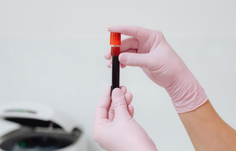 This Stuff In Blood Can Predict Alzheimer’s Disease Early