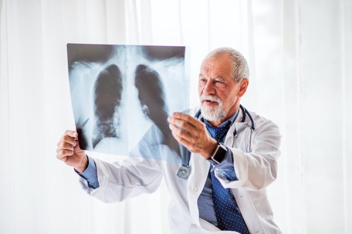 Hold your breath! Chronic lung diseases claim 3rd spot in global deaths