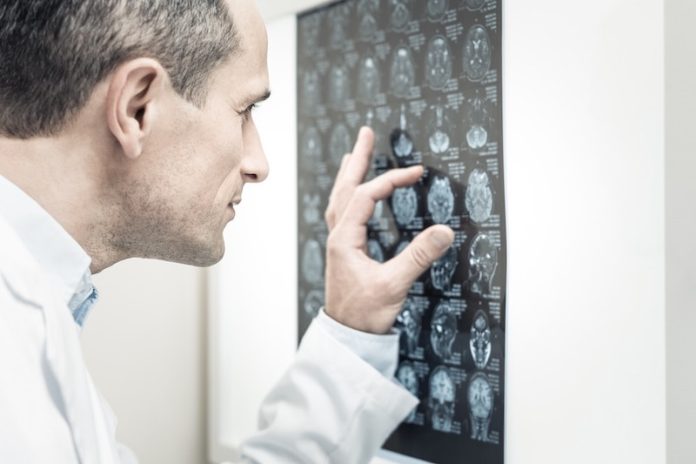 New screening technique may improve treatment for common brain cancer