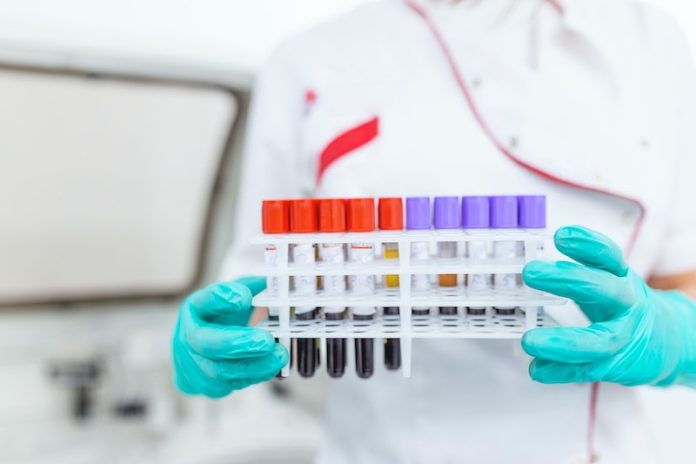 Tracking Alzheimer’s progression through simple blood tests
