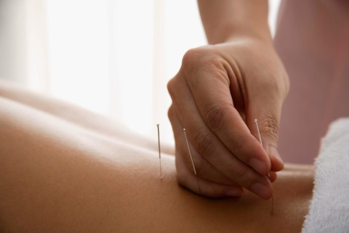 Can acupuncture help lower blood pressure