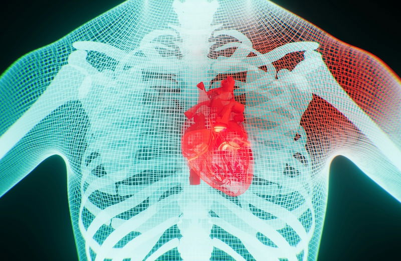 Managing fluid retention in heart failure