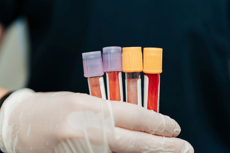 How to detect prostate cancer early