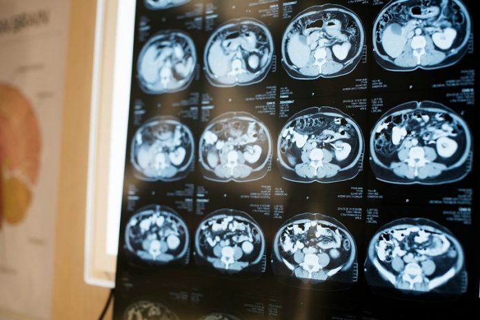 0-Scientists find how to reset brain