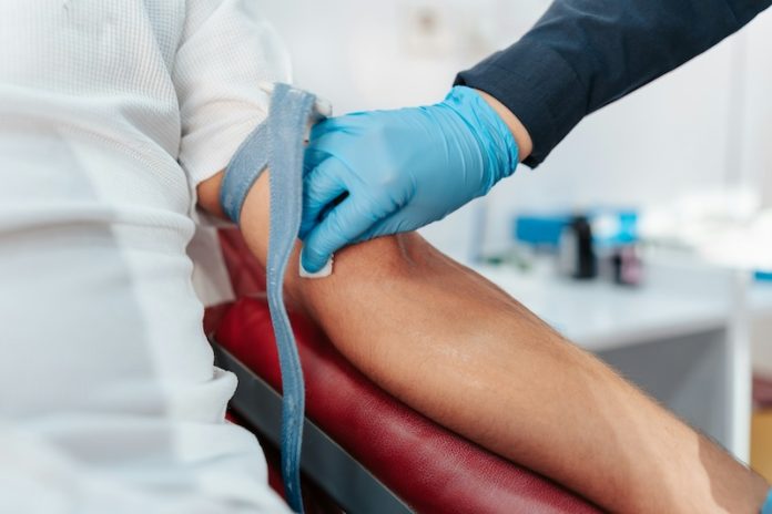 Alzheimer blood test