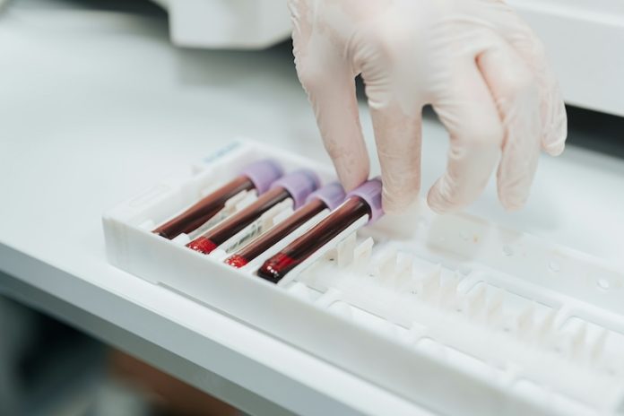 Blood test offers accurate