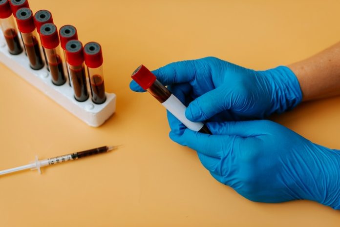 Can high cholesterol cause stroke