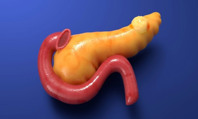 Study finds the cause of spread of pancreatic cancer