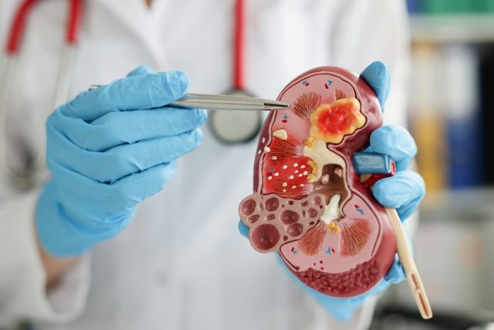 What causes kidney disease if you don
