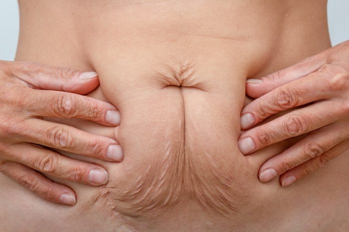 Why are more young people getting bowel cancer