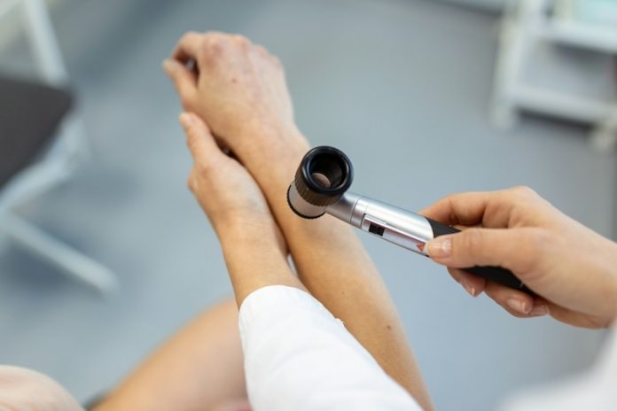 0-Blood pressure drug linked to skin cancer risk in older people