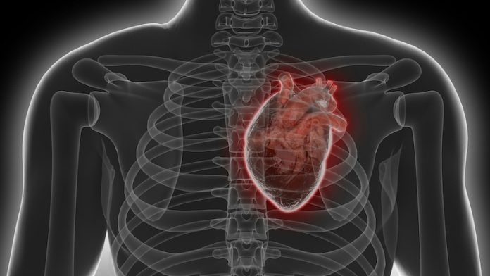 0-Coronary_Artery_Disease_Study